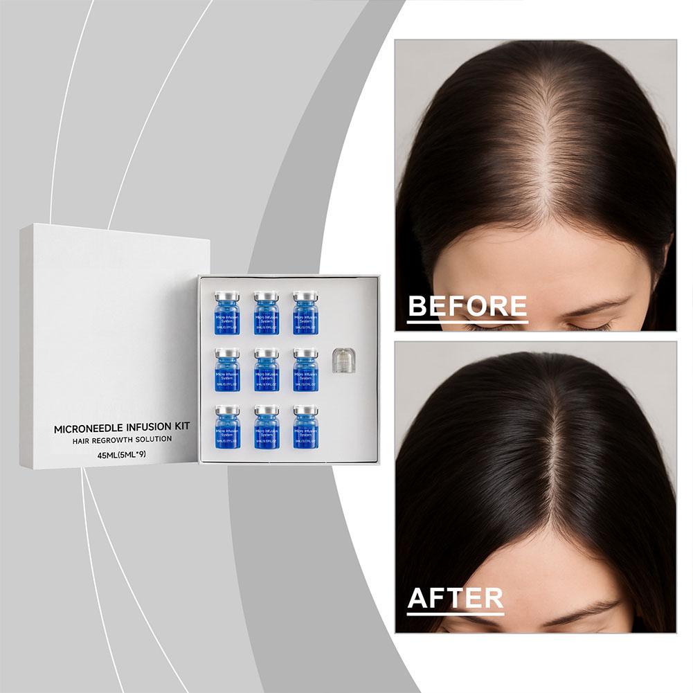 Hair Care Oil Serum - Set de Rodillo de Microagujas con
