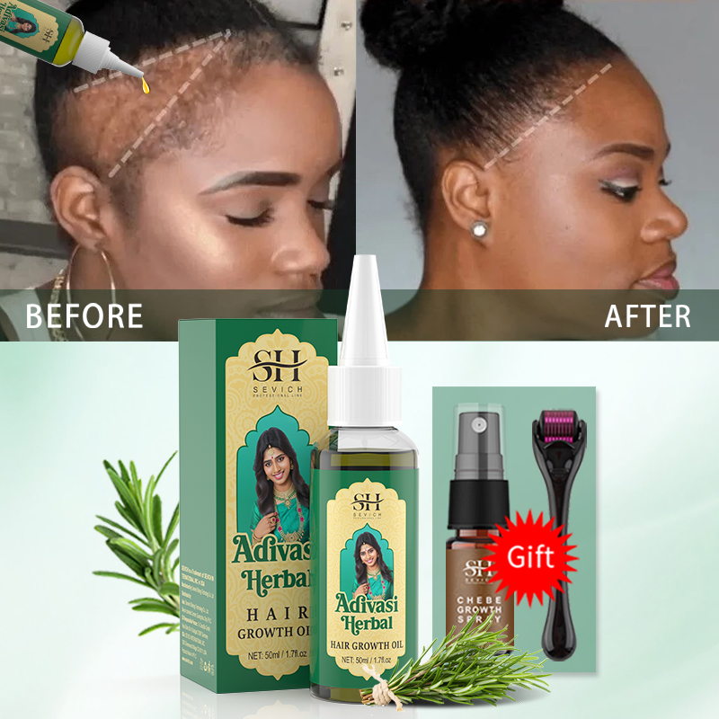 Aceite Ayurvédico para el Crec - Hair Care Essence Oil Spray reseña y precio
