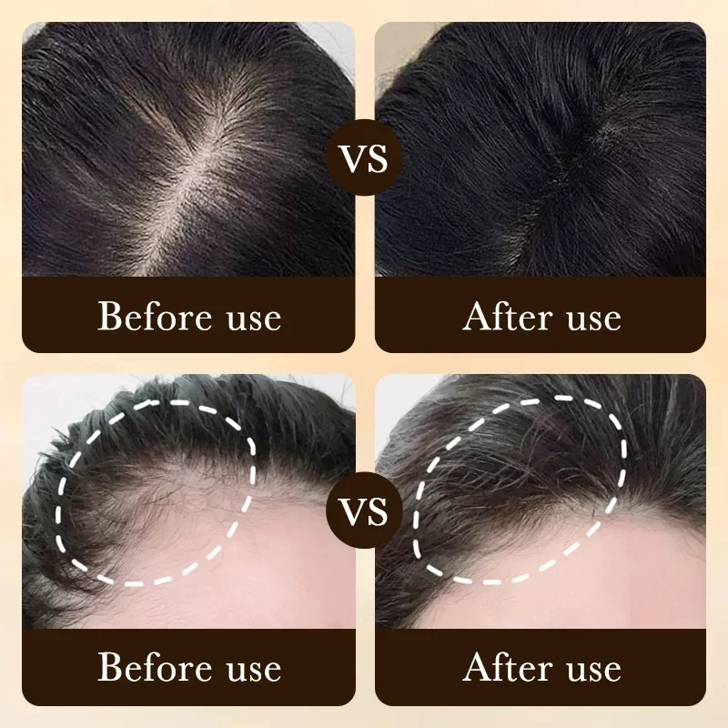 Aceite de Biotina para el Crec - Hair Care Essence Oil Spray reseña y precio
